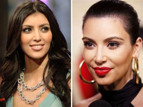 kardashian plastic surgery scandal